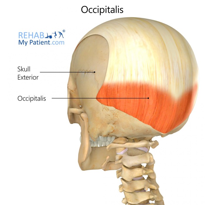 Occipital torus vs occipital bun